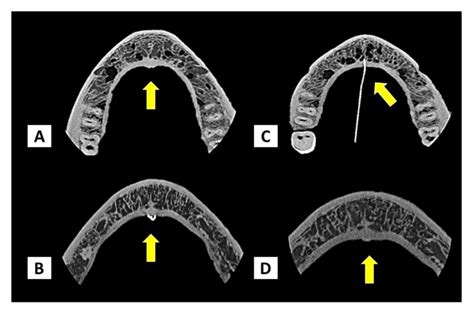 Cbct Axial Cuts Initial A Notice The Arrow Indicating The Region Of