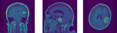 Github Galprzbrain Tumor Segmentation Pytorch Implementaion Of Unet Deep Resunet And Onet