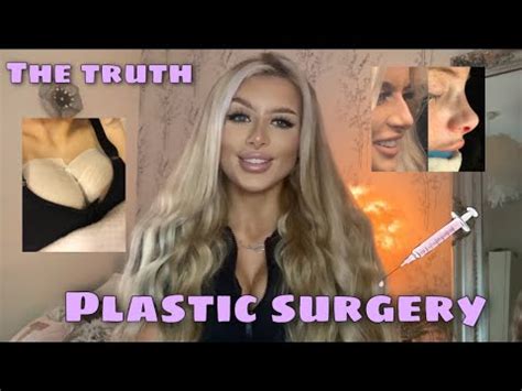 Storytime My Plastic Surgery Journey The Truth Youtube