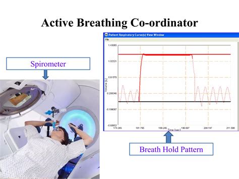 4d Scan And Respiratory Gating Pptx