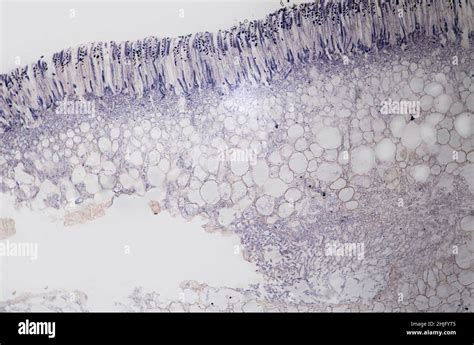 Peziza Under Microscope Labeled