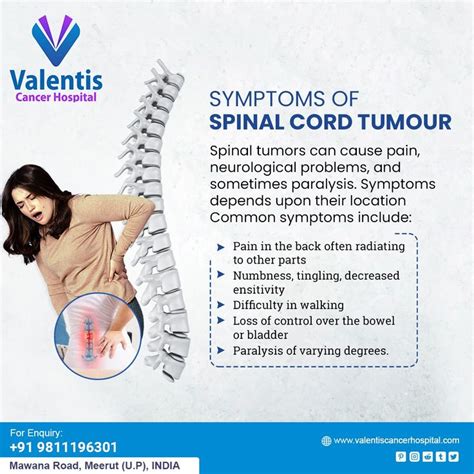 Symptoms Of Spinal Cord Tumor Spinal Pain Tumor Spinal