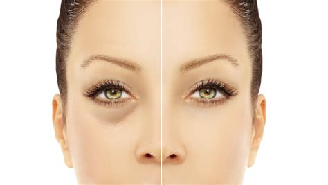 6 Anti-Aging Tips for Younger Eyes | DC Derm Docs