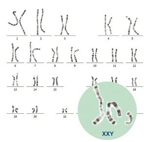 Comment Analyser Un Caryotype