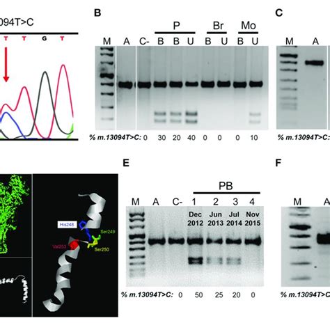 MtDNA M 13094T C Mutation A Electropherogram Showing The Presence