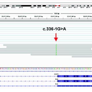 Mrna Seq Results Using The Integrative Genomics Viewer In A Web