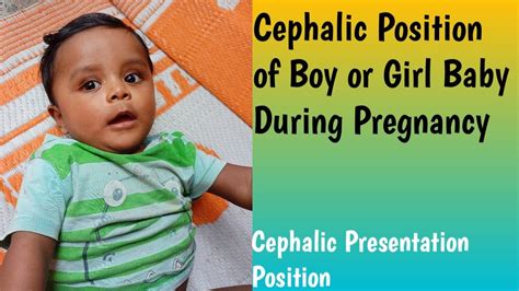 cephalic position  boy  girl baby  pregnancy cephalic