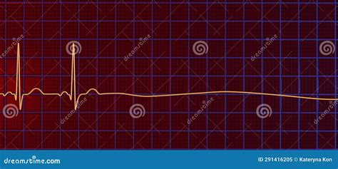 ECG In Asystole, 3D Illustration Royalty-Free Cartoon | CartoonDealer ...