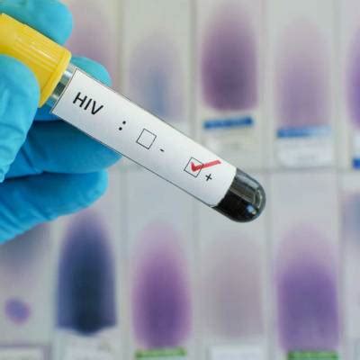 TV Nova Capital Novo paciente HIV é curado após transplante de