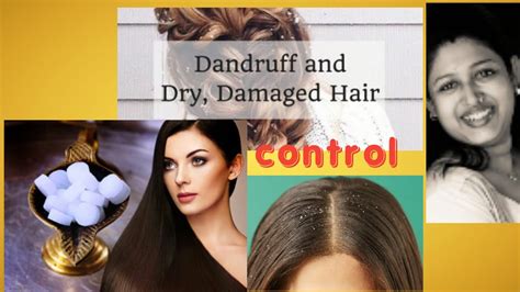 Dandruff Control Bangla Dandruff Solution How To Clear Dandruff