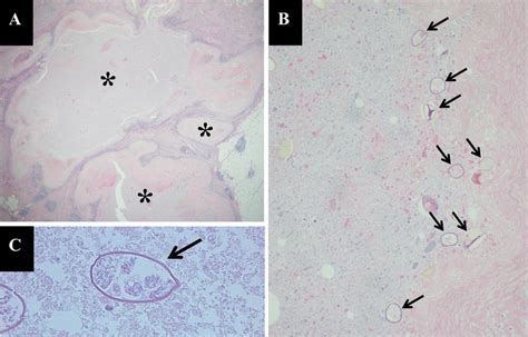 Histological Specimen Hande Stain A On Low Power × 125 Image