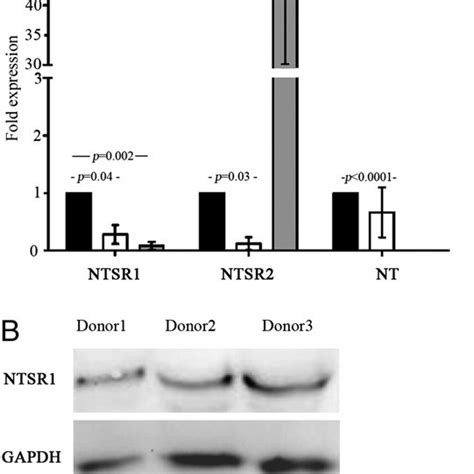 A Transcription Of Neurotensin Nt Its Two G Protein Receptors