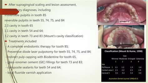 Pulpotomy Management Using Laser Diode In Pediatric Patient Journal Club Ppt