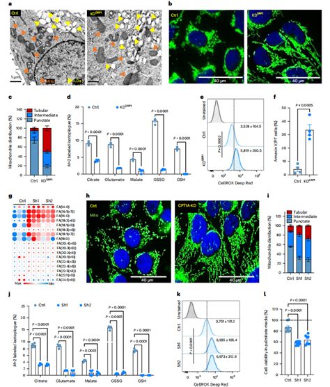 DRP1驱动的线粒体可塑性诱导代谢重编程可减少乳腺癌脑转移