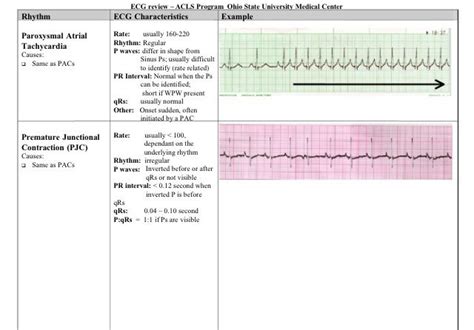 Ekg Technician Pay Rate Sitha Salary