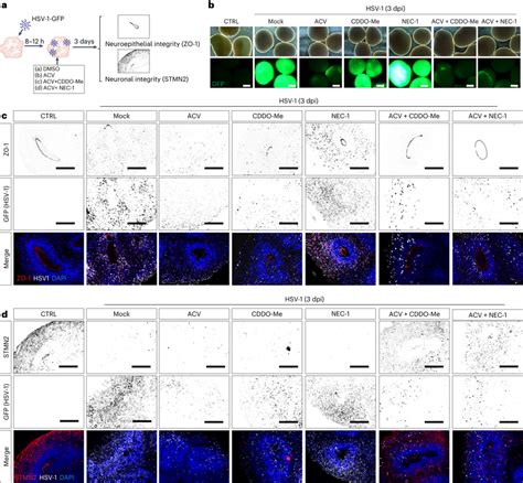 Combinatorial treatment strategies for HSV-1-driven... | Download Scientific Diagram