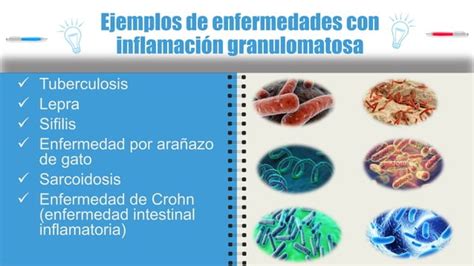 Inflamacion Granulomatosa Patolog A Ppt