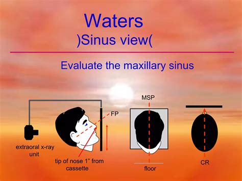 Extra Oral Radiology Techniques Ii Ppt