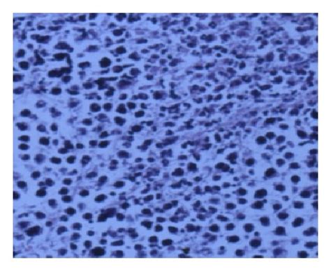 Antitumor Effect In Vivo Upper Panel Histological Analysis Of Tumor