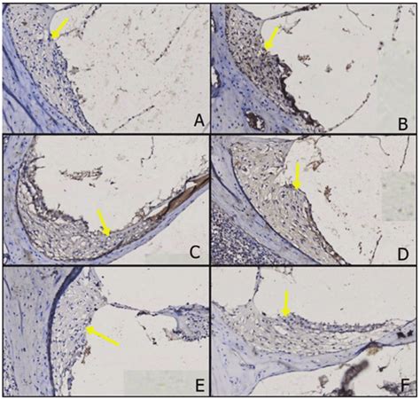 The Expressions Of Pkc In Each Group Under Magnification A