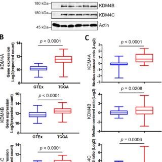 Kdm A Kdm B And Kdm C Are Overexpressed In Pca A Expression Of