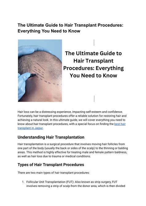 Ppt The Ultimate Guide To Hair Transplant Procedures Everything You