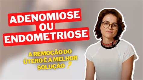 A Remo O Do Tero A Melhor Solu O Para A Minha Adenomiose Ou