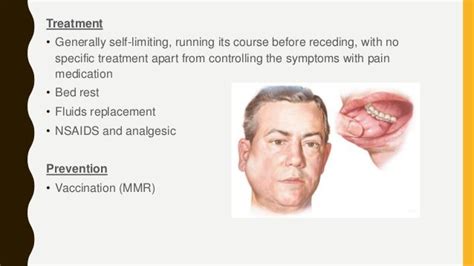 Parotid Gland Swelling