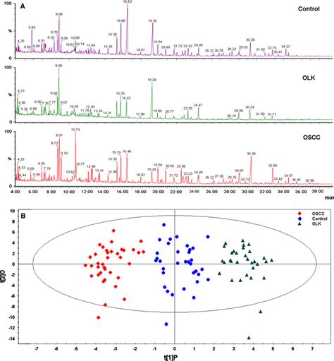 A Typical Gc Ms Total Ion Current Tic Chromatograms Of Oscc Olk And