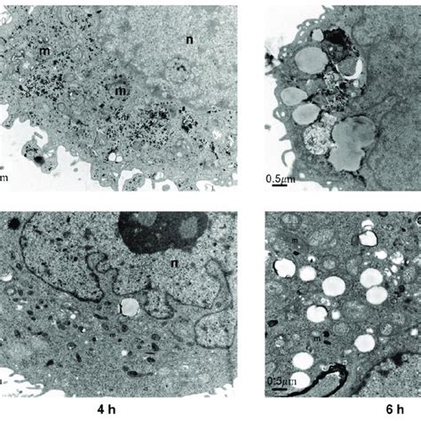 The Transmission Electron Microscopy Images Of PEG AuS On SGC 7901 And