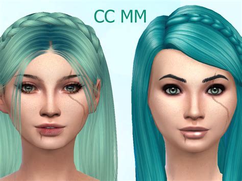 Sims 4 Acne Scars