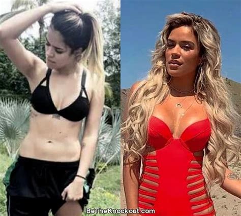 Karol G Plastic Surgery Comparison Photos