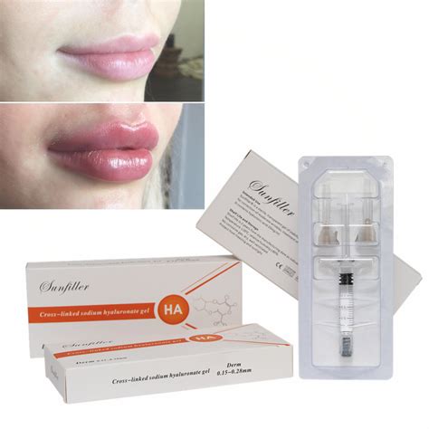 CE Sunfiller Lip Injection Price Dermal Filler Hyaluronic Acid Derm