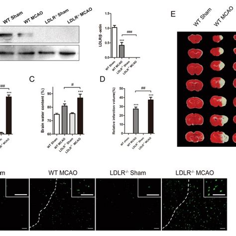 Schematic Diagram For The Mechanisms Of LDLR In The Regulation Of