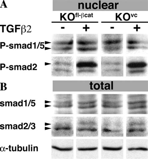 The Absence Of β Catenin Does Not Modify Smads And Their Download