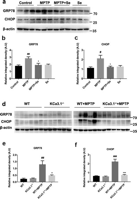 Genetic Kca Deletion And Pharmacological Blockade With Senicapoc