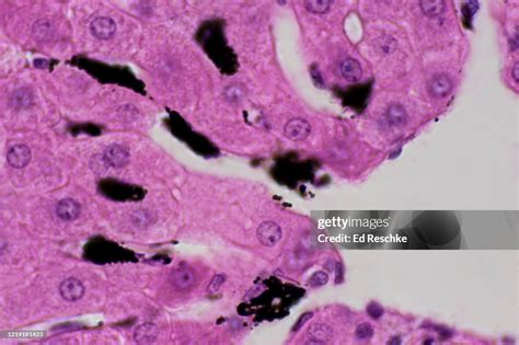 Liver Sinusoids