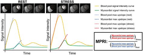 The Myocardial Perfusion Reserve Index Mpri Is The Ratio Of The