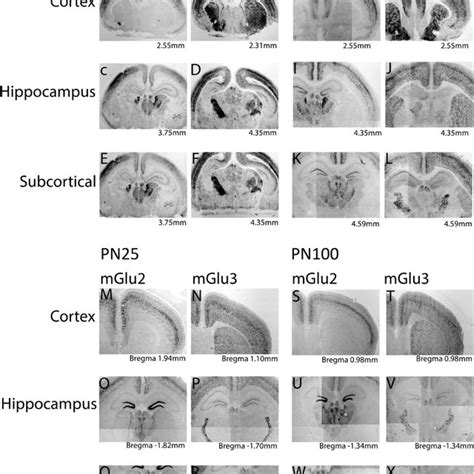 Mglu And Mglu Mrna Expression Throughout Development In Situ