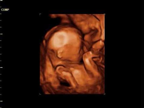 3d 4d Ultrasound Pictures At 18 Weeks - PictureMeta