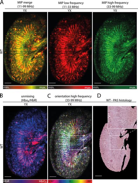 Multispectral raster scanning optoacoustic mesoscopy imaging. A... | Download Scientific Diagram