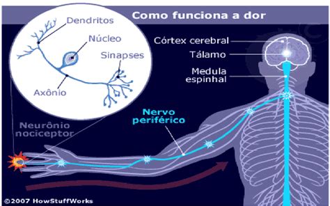 Fisiologia Da Dor Como Funciona A Dor