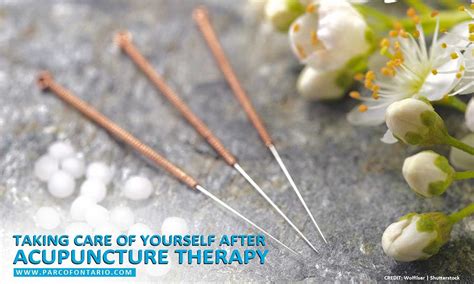 Taking Care Of Yourself After Acupuncture Therapy The Physiotherapy And Rehabilitation Centres