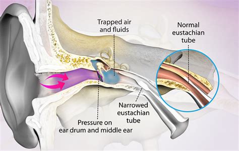 Health Condition : Symptoms, Causes, Treatment and More