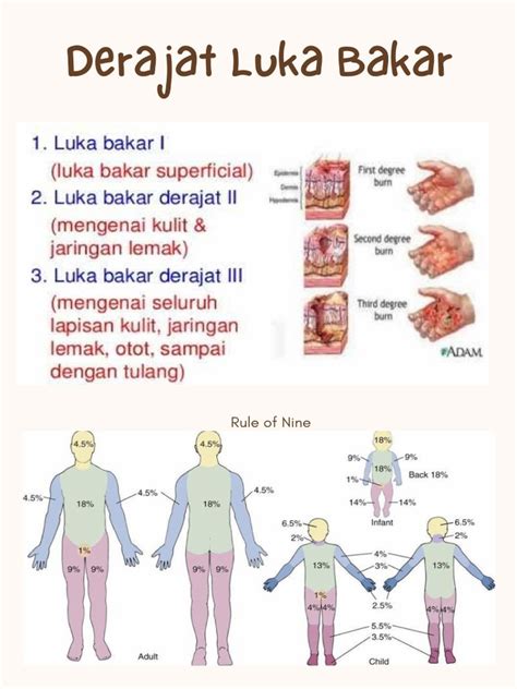 Derajat Luka Bakar Pdf