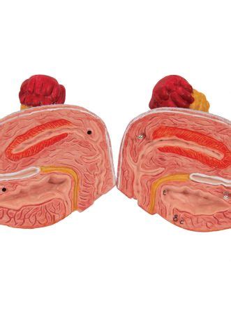 Dual Sex Urinary System Model 6 Part 3B Smart Anatomy SEM Trainers