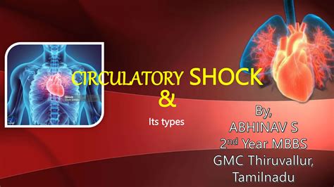 Circulatory Shock Cardiogenic Shock Hypovolemic Shock Sepsis Septic