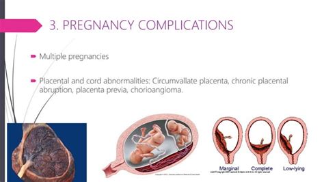 Intrauterine Growth Restriction Iugr Small For Gestational Age