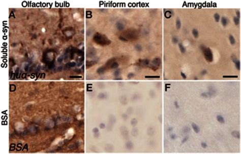 Uptake Of Syn In The Olfactory Bulb And Transfer Of Soluble Syn To