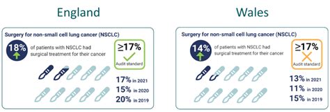 Blog Findings From The New National Lung Cancer Audit ‘state Of The